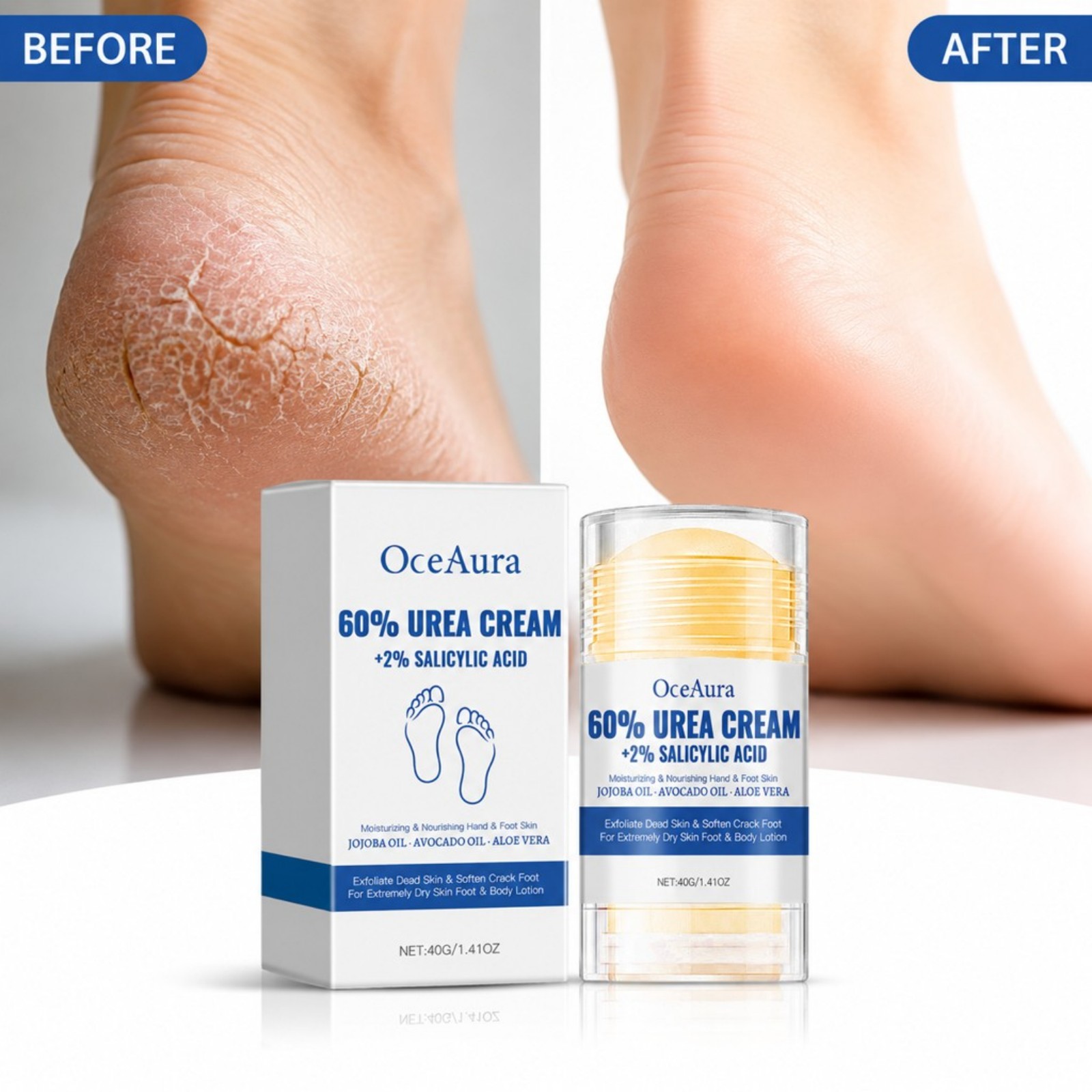 60% Urea Foot Care Cream Stick - đánh giá và giá Urea Foot Cream